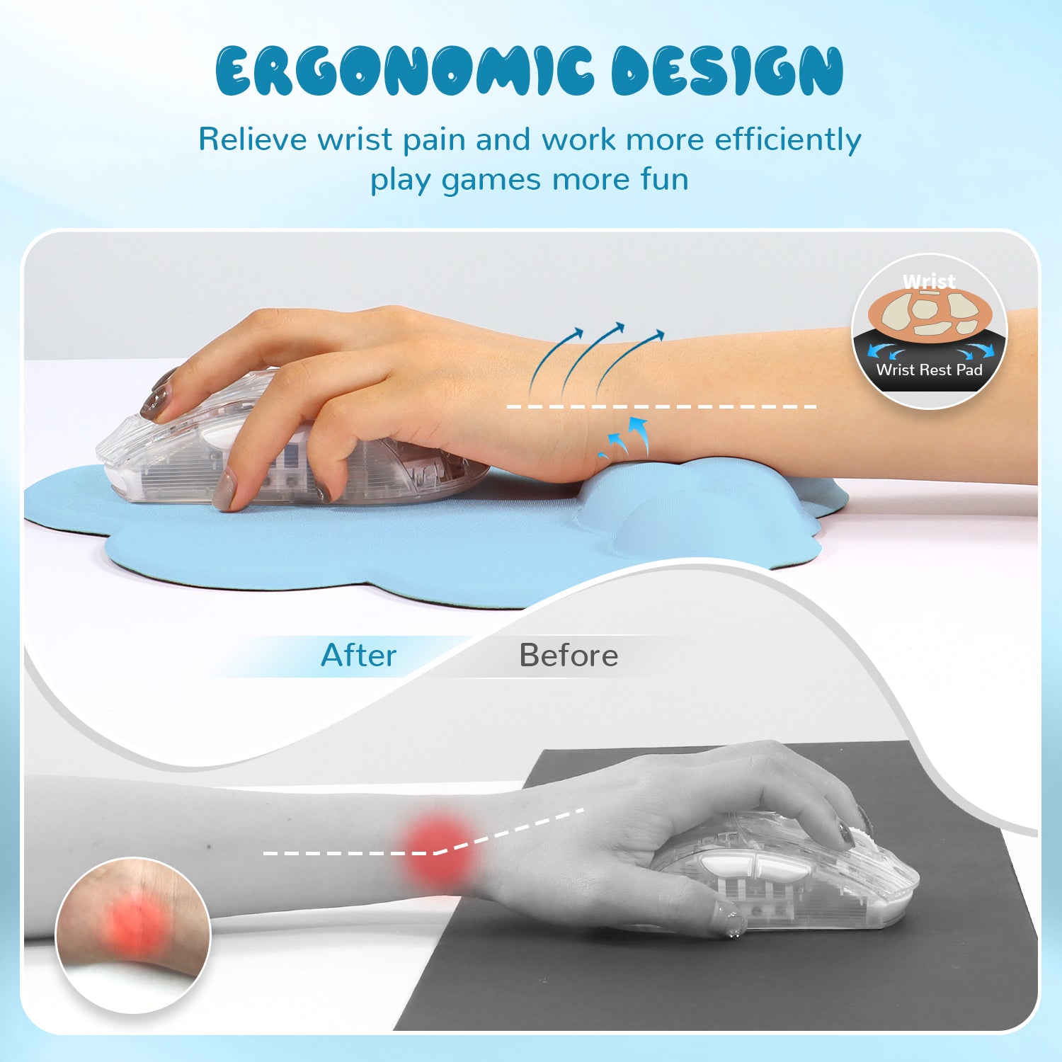Before and after comparison of wrist pain relief using cloud-shaped ergonomic mouse pad.
